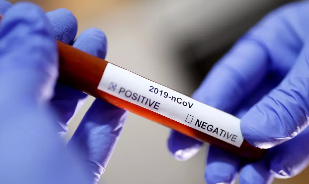 DRUHÝ POTVRZENÝ PŘÍPAD NAKAŽENÍ KORONAVIREM