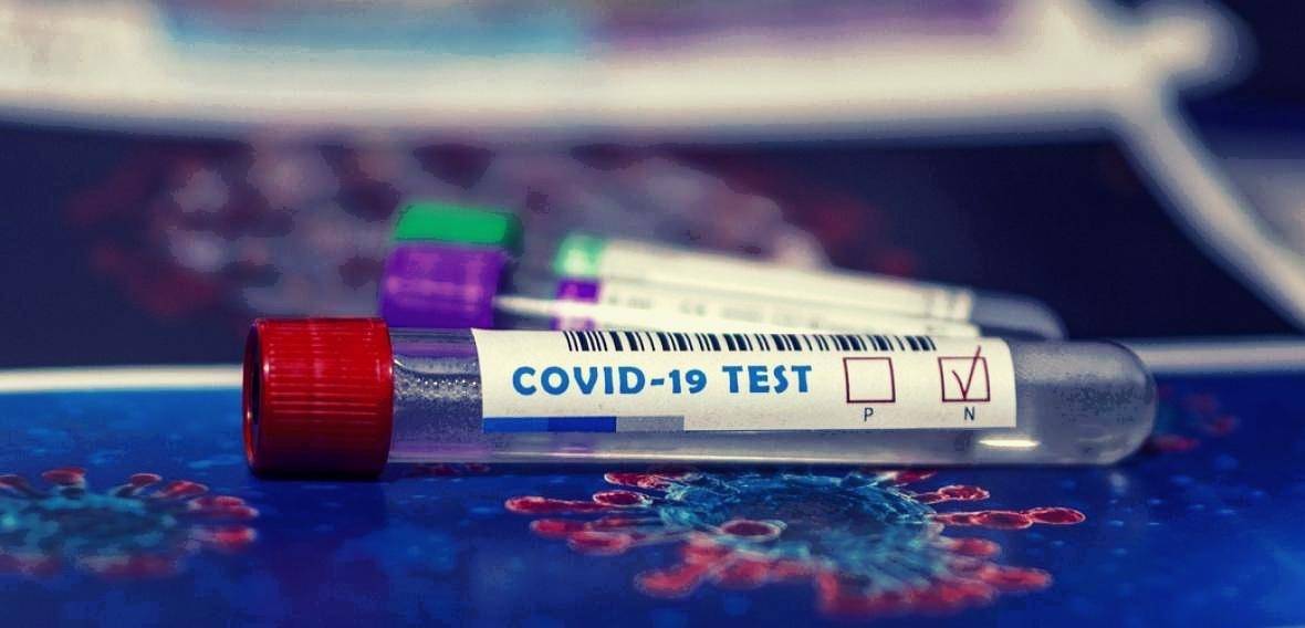 ANTIGENNÍ TESTOVÁNÍ V JESENÍKU